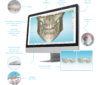 Spark™ - Doctor Site - Innovative & Advanced Aligner System