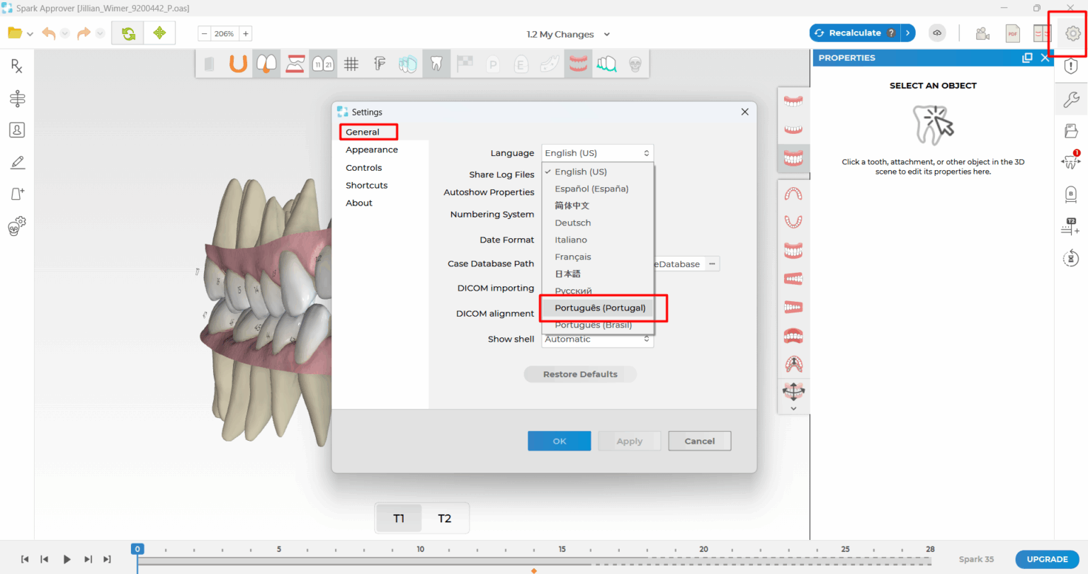 Ormco - Spark™ Releases - Latest Updates on Spark Aligners