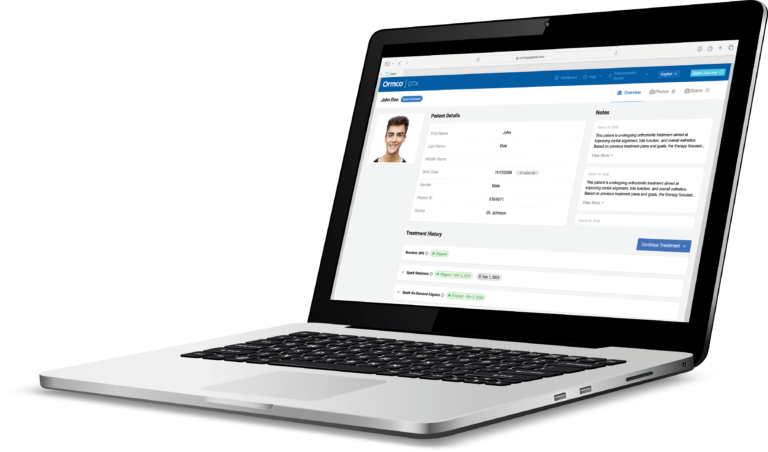 Ormco - Spark™ Releases - Latest Updates on Spark Aligners