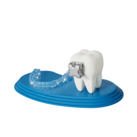 Ormco Forum 2027_Aligner and brackets 1 Ormco Forum 2027_Aligner and brackets 1